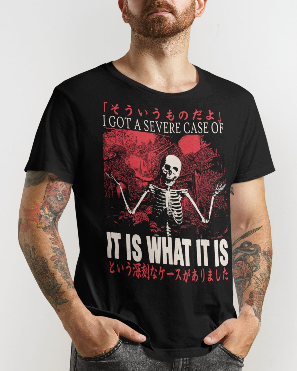 Severe Case' Shirt